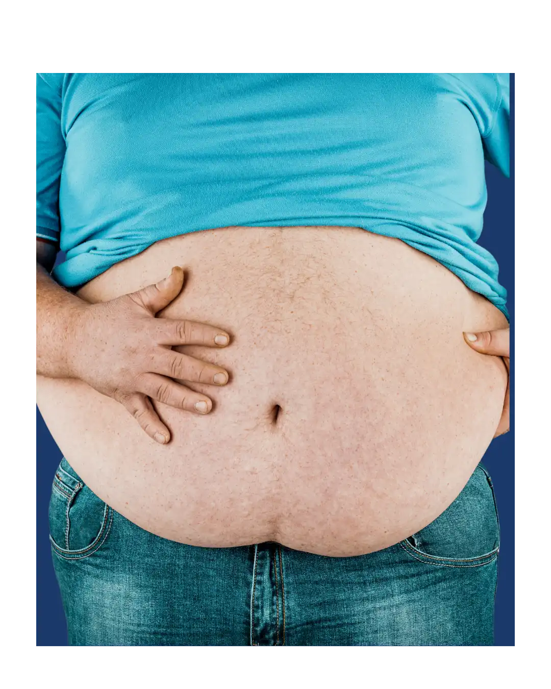 Chirurgie bariatrique en Tunisie : sleeve gastrique, bypass